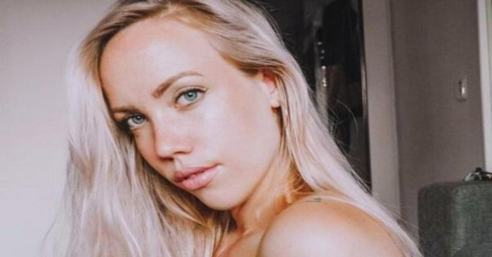 She changed her life with one decision!” Tired of the bullying, a young woman with a large forehead underwent a hair transplant — and the before-and-after photos are stunning. See the transformation that left everyone speechless in the comments below