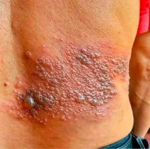 These are the consequences of sleeping on this manner!