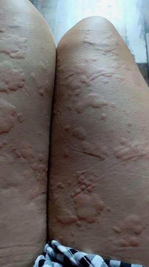 When Sleeping on a Dirty Bed Becomes a Hidden Health Risk