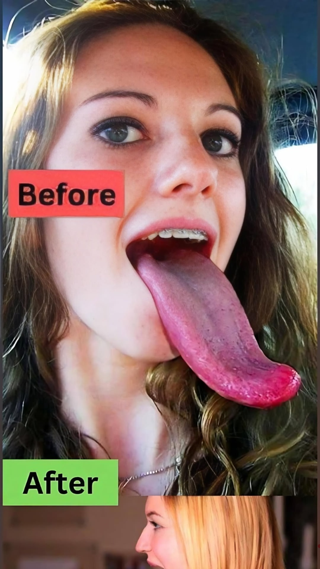 The Abnormality of the Girl&rsquo;s Tongue: Analysis and Causes