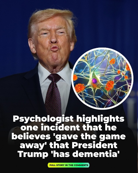 The psychologist identifies an incident he believes &ldquo;exposed&rdquo; signs of dementia in President Trump